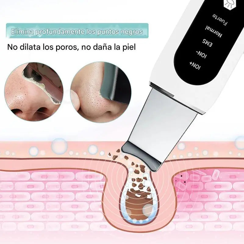 Peeling Ultrasónico Portátil 5 en 1 - Dermasonic