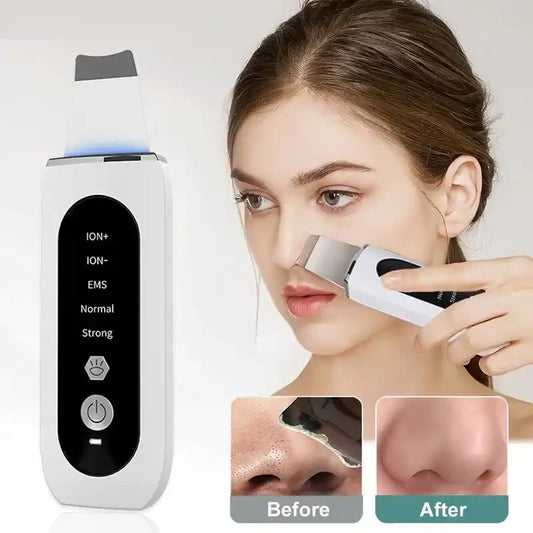 Peeling Ultrasónico Portátil 5 en 1 - Dermasonic