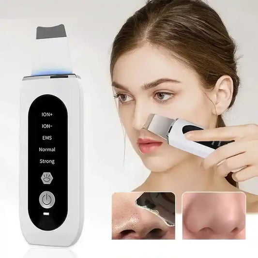 Peeling Ultrasónico Portátil 5 en 1 - Dermasonic